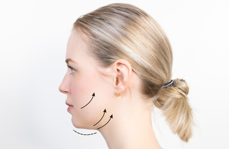 Lipolyse